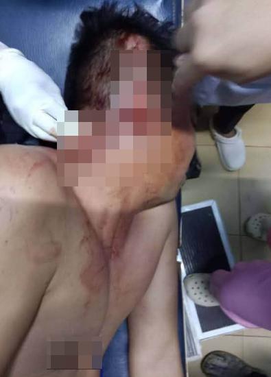 柬埔寨柏威夏省库伦县宪兵司令陈西少校在自家后院凉亭的吊床上休息时,遭37岁同村农…